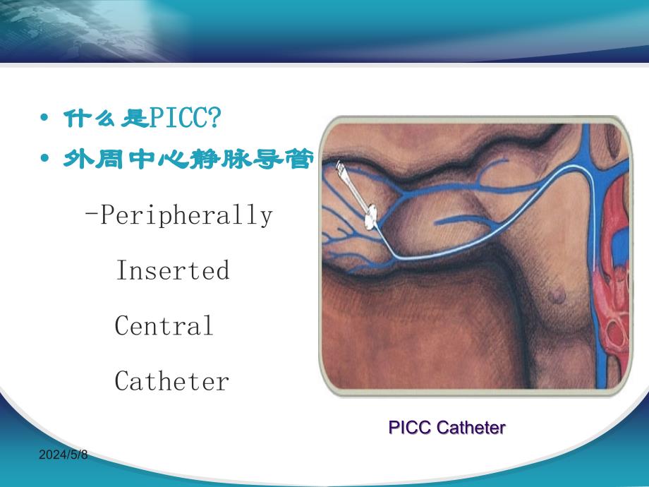 picc维护过程中常见并发症的预防及处理_第2页