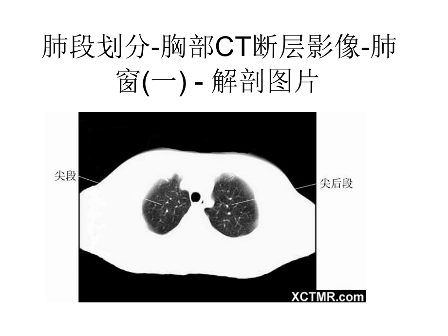 胸、腹、盆腔ct_第2页