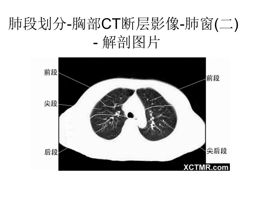 胸、腹、盆腔ct_第3页