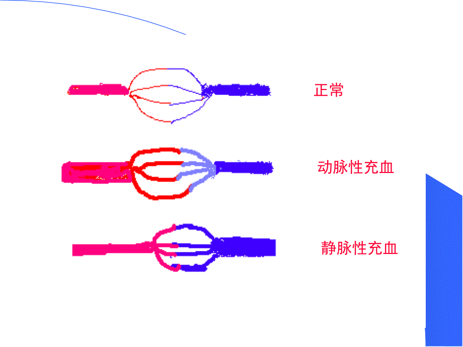 局部血液循环障碍病理学_第4页