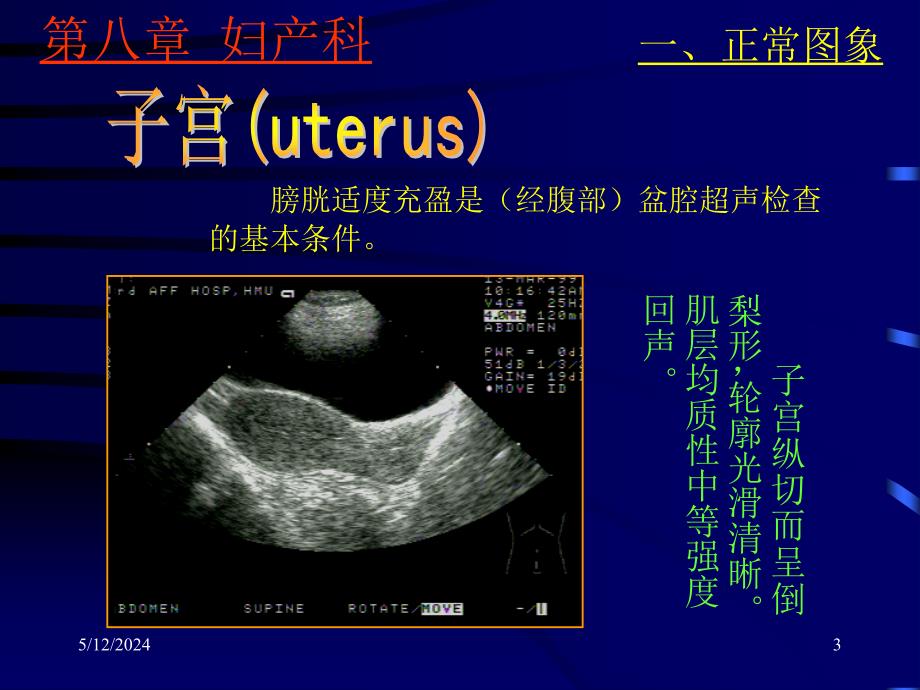 上海交大妇产超声_第3页