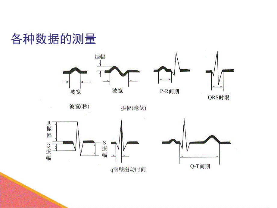 心电图基础知识1_第3页