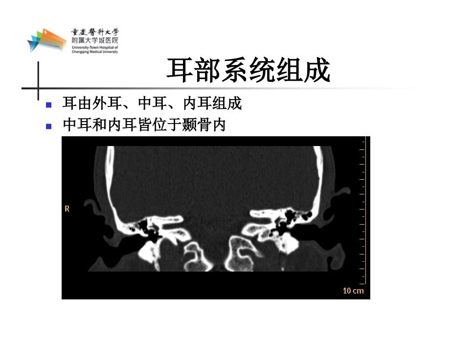 耳部ct解剖(大学城医院)_第3页