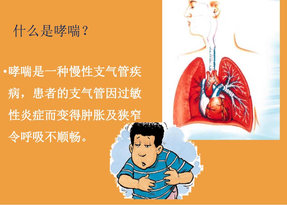 支气管哮喘防治-中医药大附3院-张羽-2018-04-27_第3页