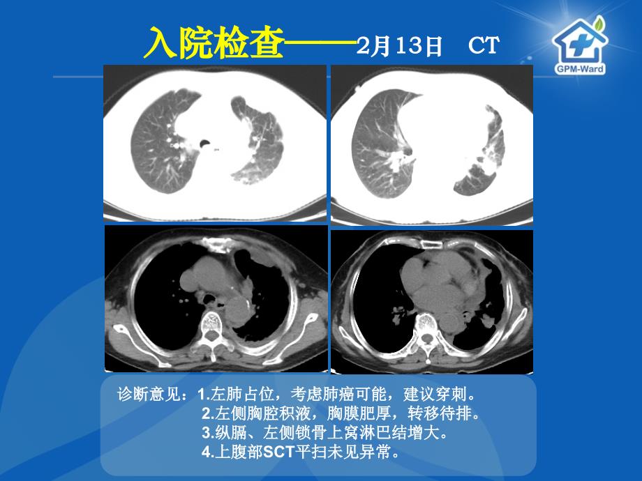 癌痛病例分享（郑大一附院王峰）_第3页