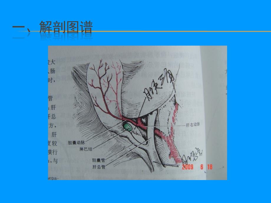 手术室护理——血腹腔镜下胆囊切除、胆道镜下胆总管切开取石、胆总管一期缝合术_第2页