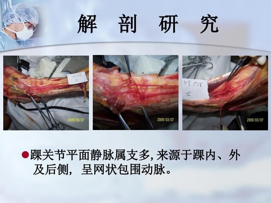 武汉大学人民医院李亚明教授胫前-足背血管在组织瓣移植中的临床应用_第5页