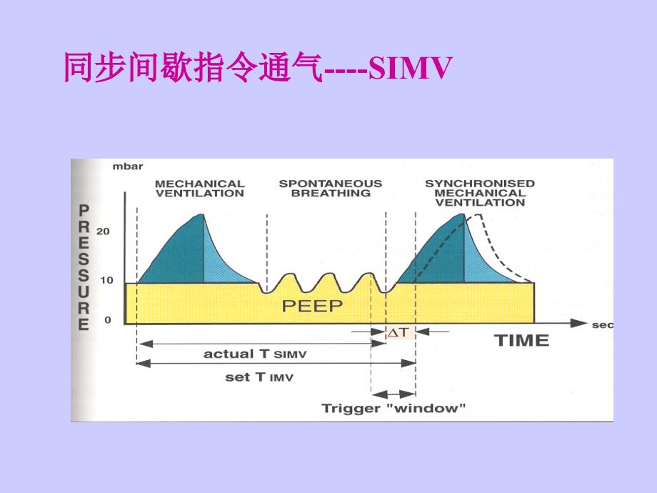 机械通气基础及基本临床应用2_第2页