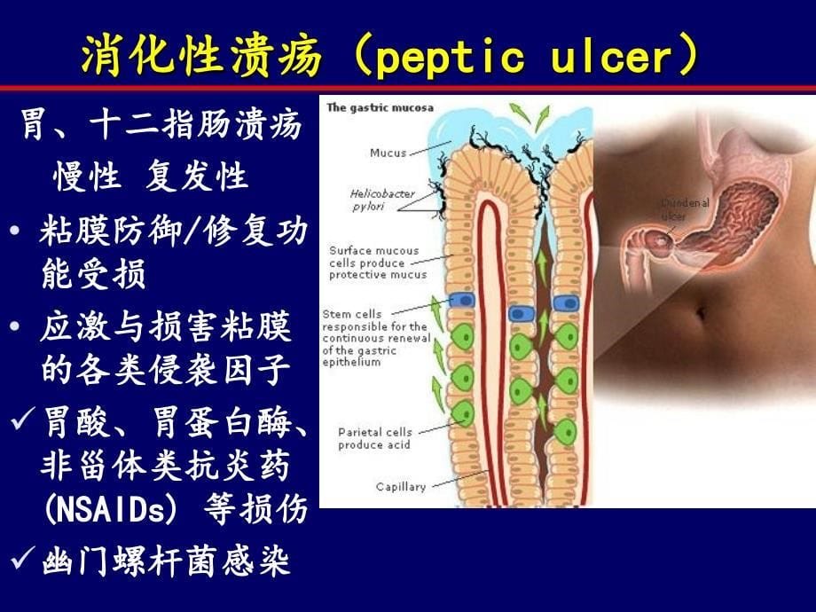 药理学消化、呼吸、血液系统药物_第5页