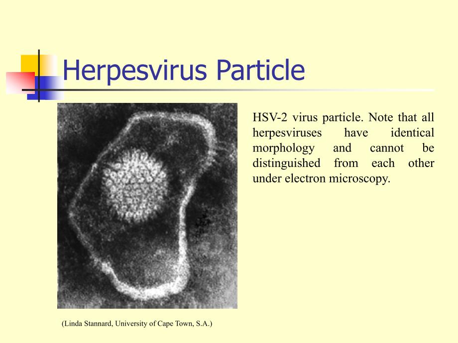 herpesviruses(水痘-带状疱疹病毒)_第3页