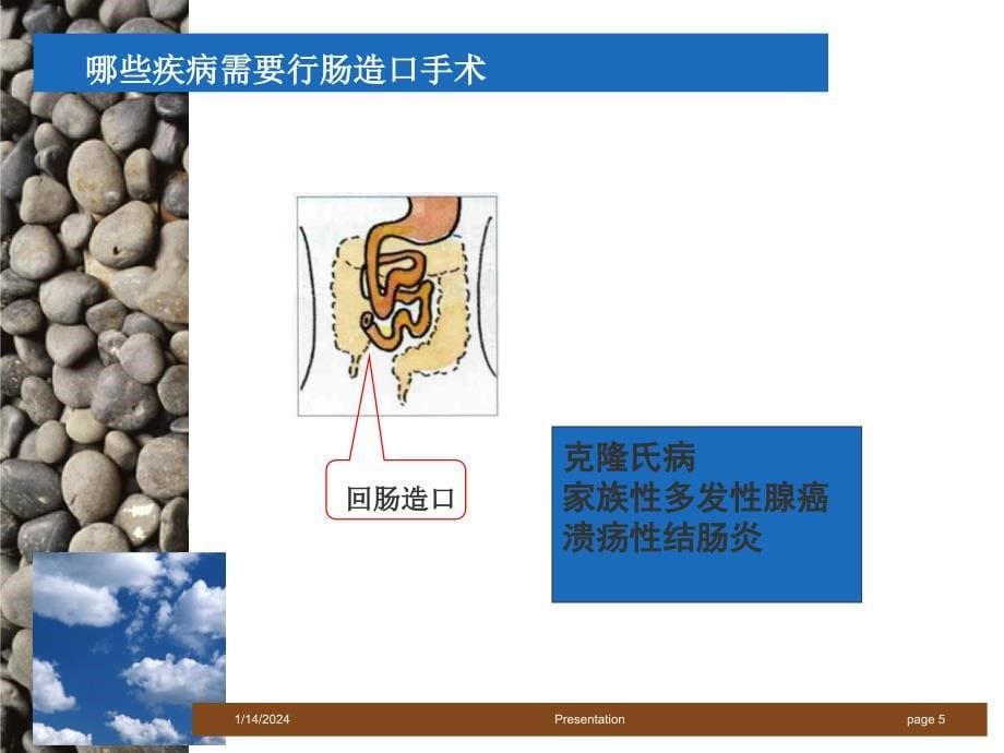 直肠癌的治疗及护理_第5页