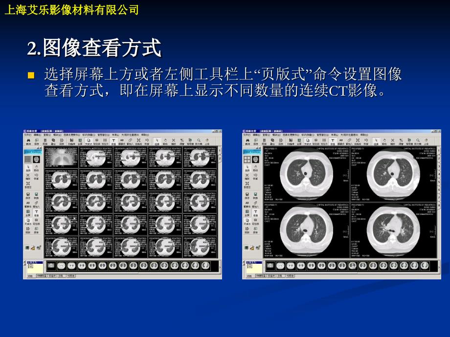 医学图像后处理技术 (2)_第4页