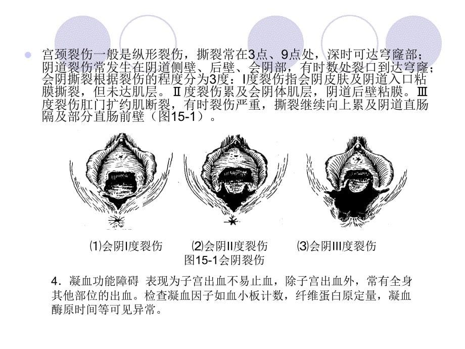 常见产时并发症中西医结合妇产科学_第5页