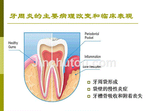 牙周炎的伴发病变