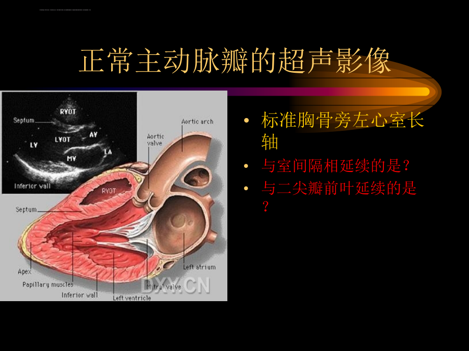 主动脉-肺动脉瓣疾病_第4页