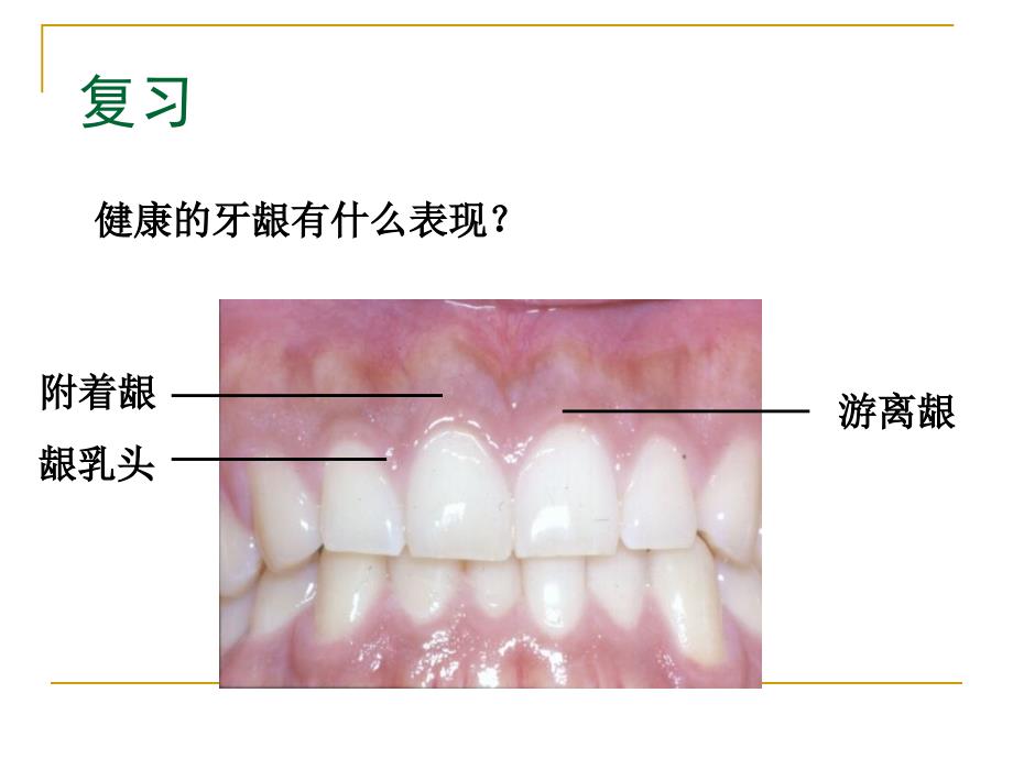 口腔内科学牙龈病(大课)_第3页