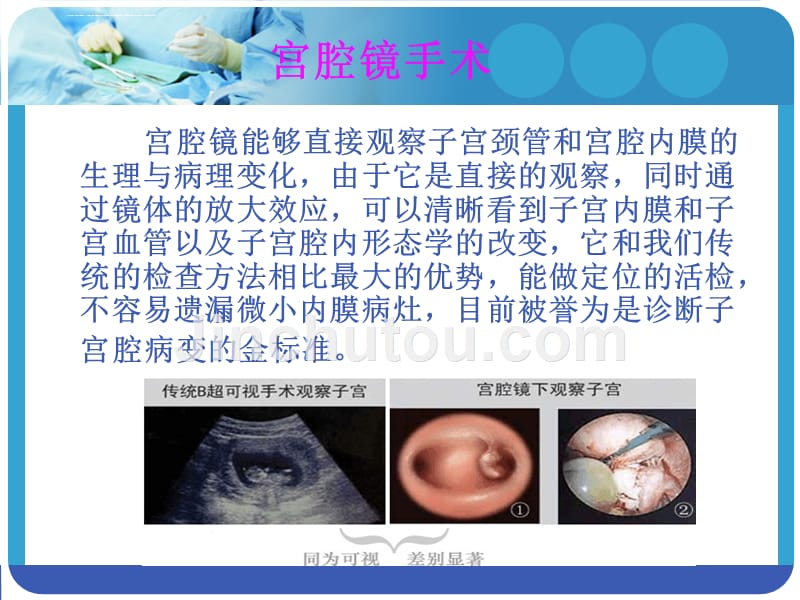 宫腔镜、腹腔镜手术常见并发症处理及预防--杨妹2014.3.26_第2页