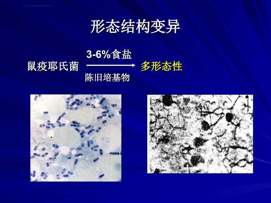 医学微生物学遗传变异课件_第4页