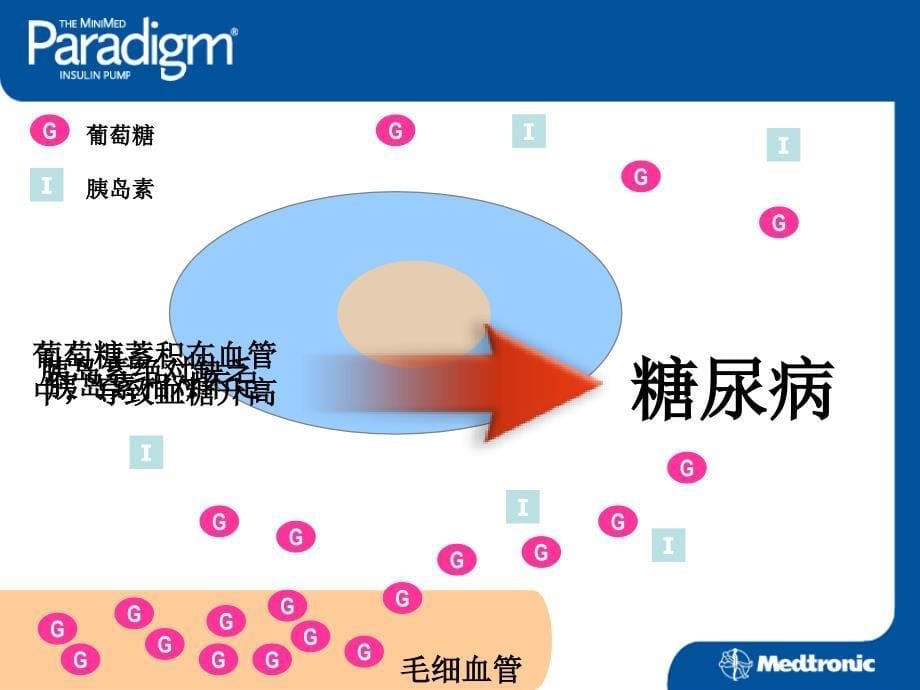 胰岛素泵患者教育_第5页