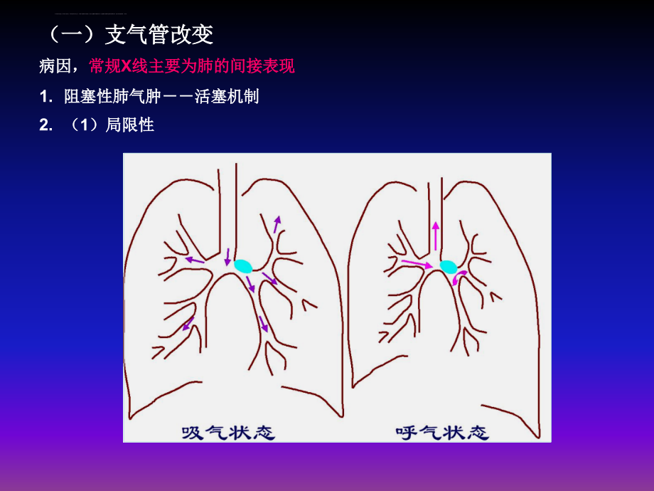 呼吸系统x线基本病变课件_第2页
