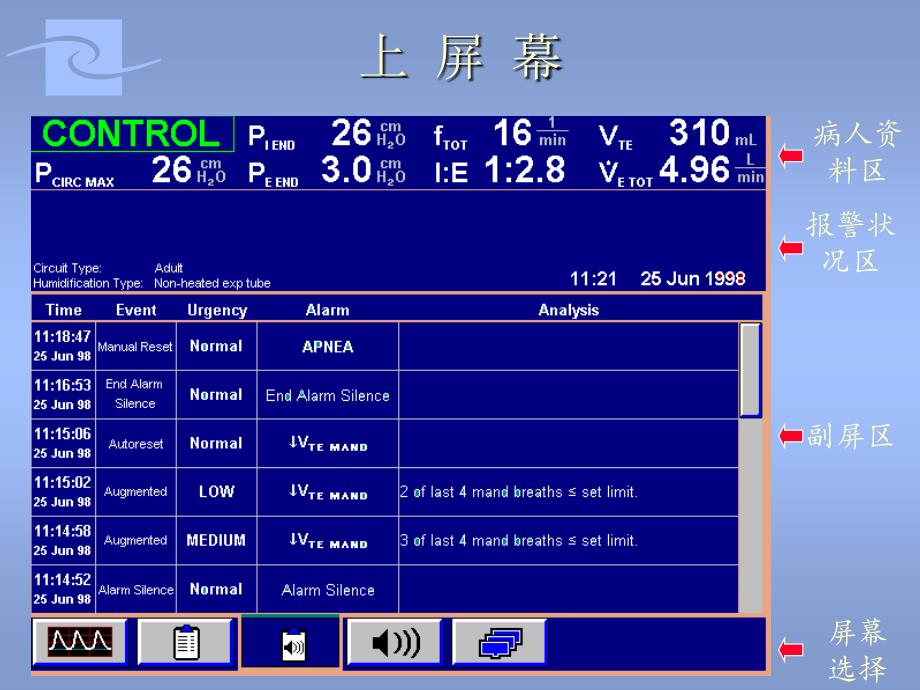 pb-840-呼吸机操作说明_第4页