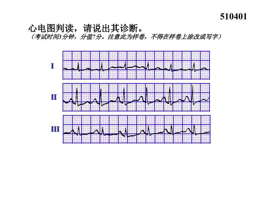 执业医师实践技能考核(三)心电图试题集课件_第4页