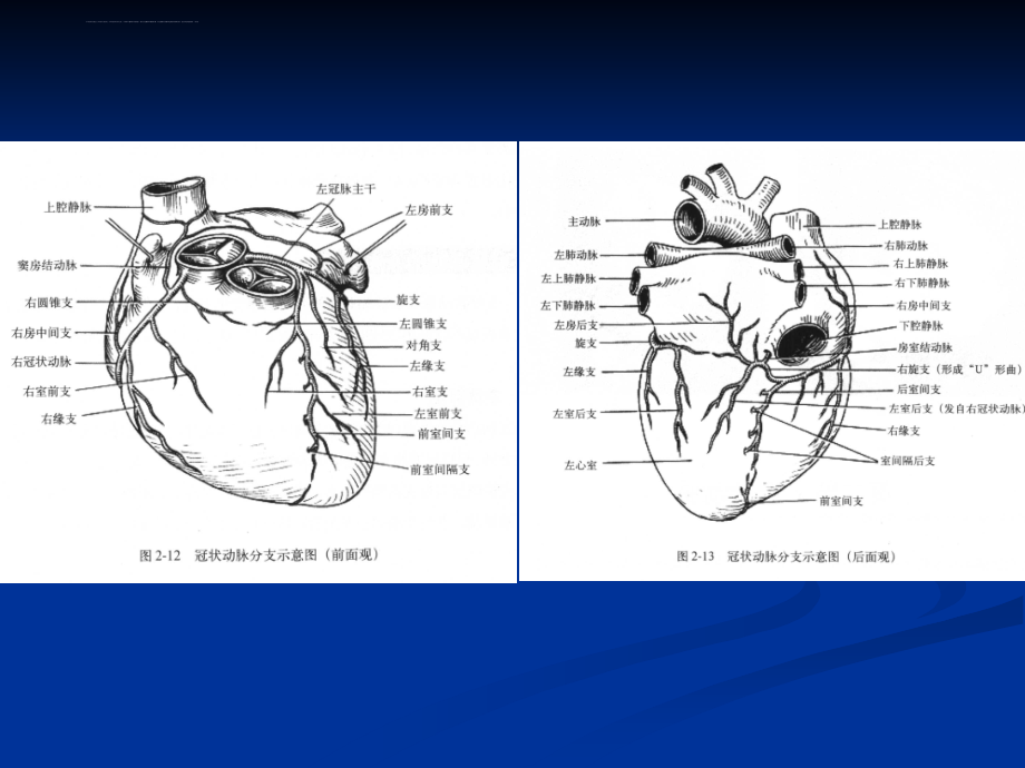 冠状动脉解剖与冠心病ct课件_第4页