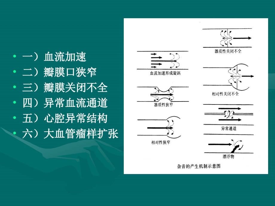 心脏杂音、血管检查_第4页