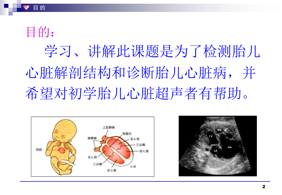 新版胎儿心脏解剖结构的超声判定课件_第2页