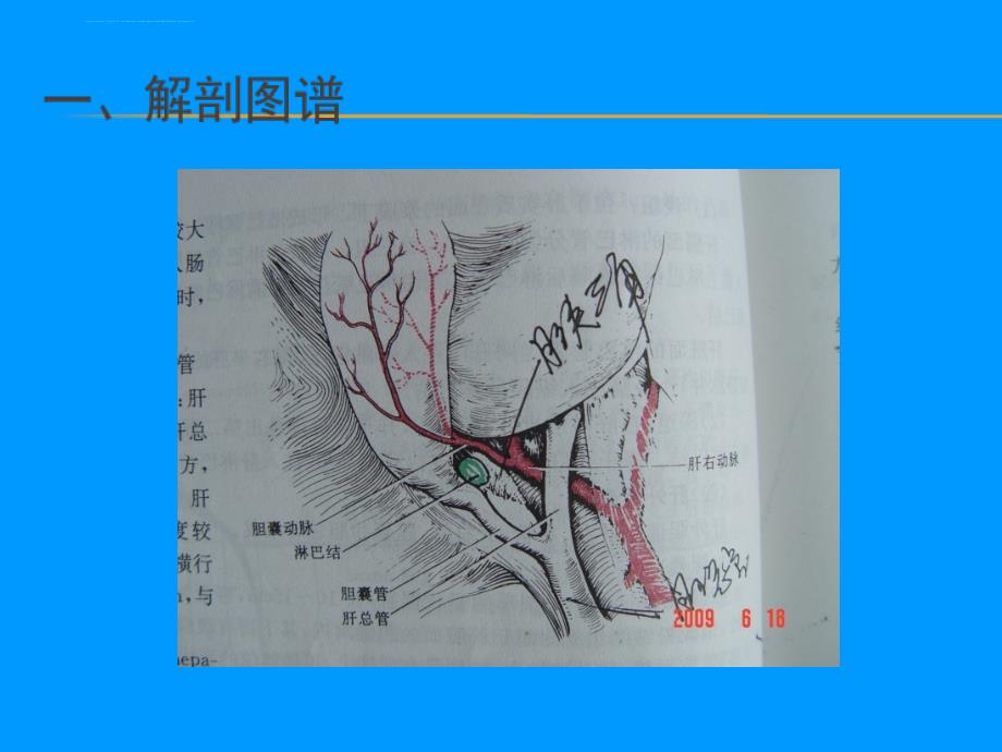 手术室护理——血腹腔镜下胆囊切除、胆道镜下胆总管切开取石、胆总管一期缝合术课件_第2页