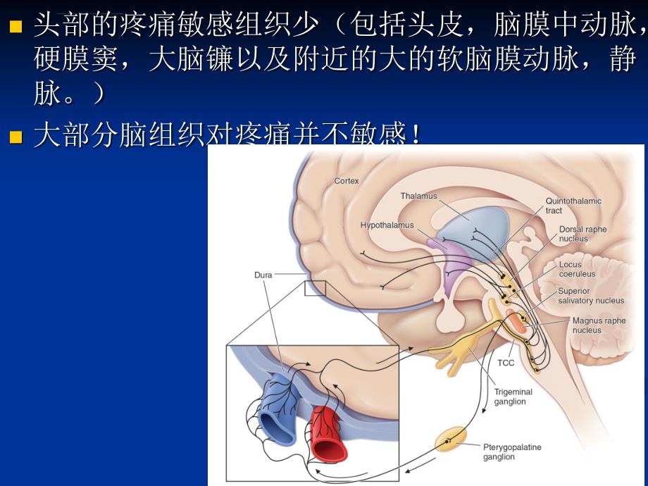 2015-神经病学：头痛课件_第2页