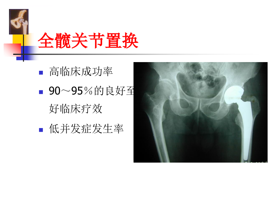 tha围手术期处理课件_第2页