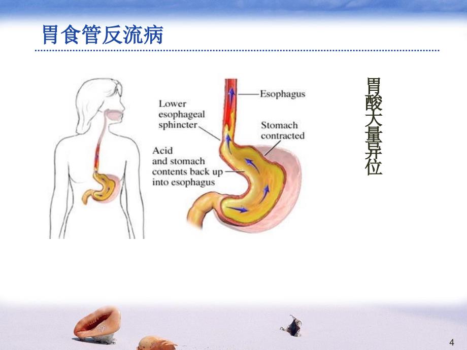 ppi药物及其临床应用6.8_第4页