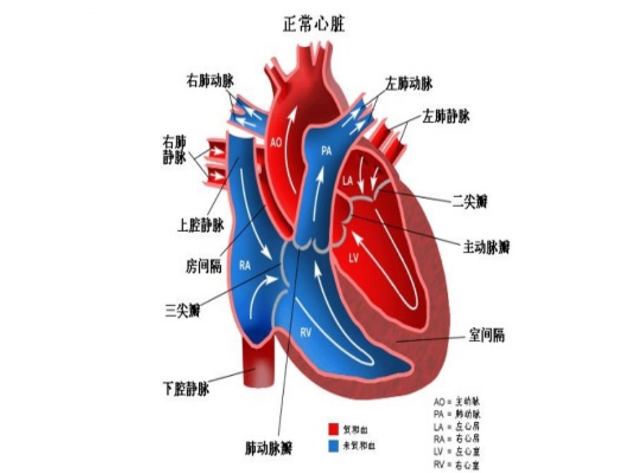 常见先心病解剖图片课件_第2页