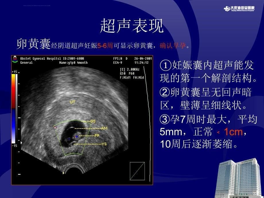 早晚孕(陈金玉)20161205课件_第5页