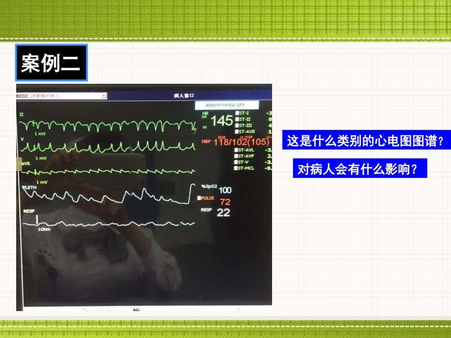 医护合作ppt(06-17张建凤)_第3页