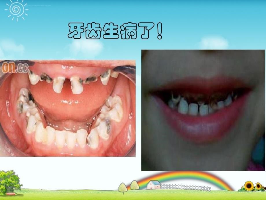 幼儿园小班《保护牙齿》课件_第5页