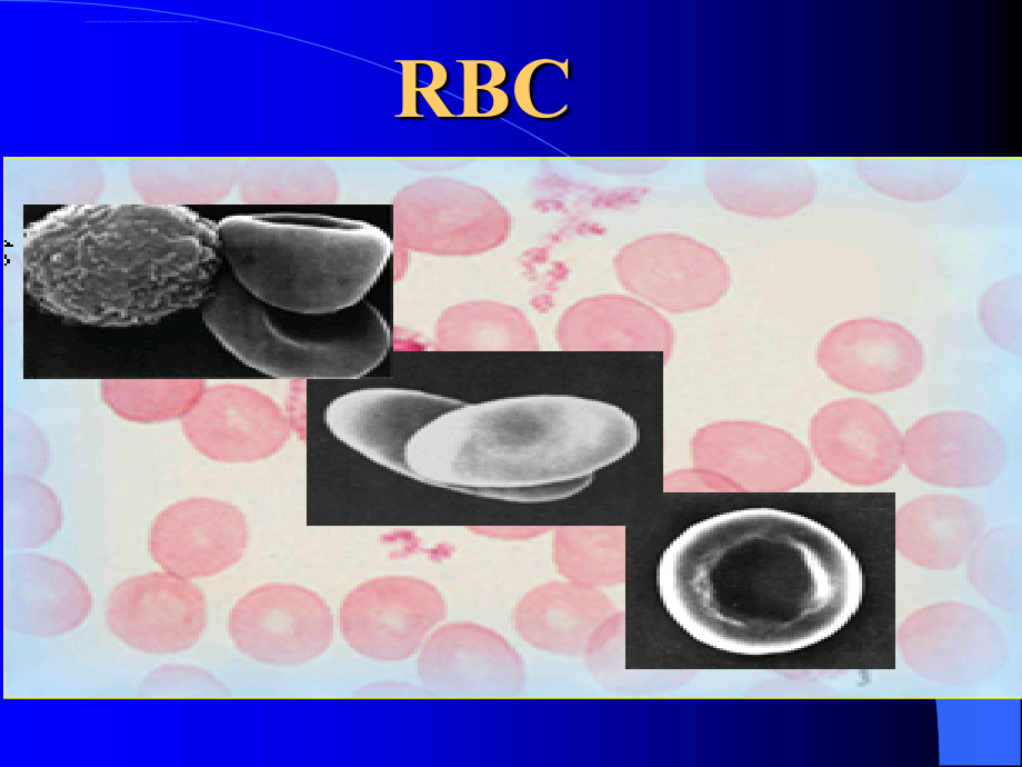 临床医学检验红细胞的检查以及临床意义课件_第3页