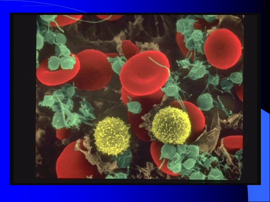 临床医学检验红细胞的检查以及临床意义课件_第4页