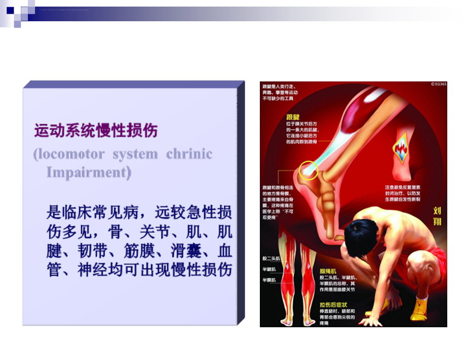 运动系统慢性损伤裴国献课件_第3页
