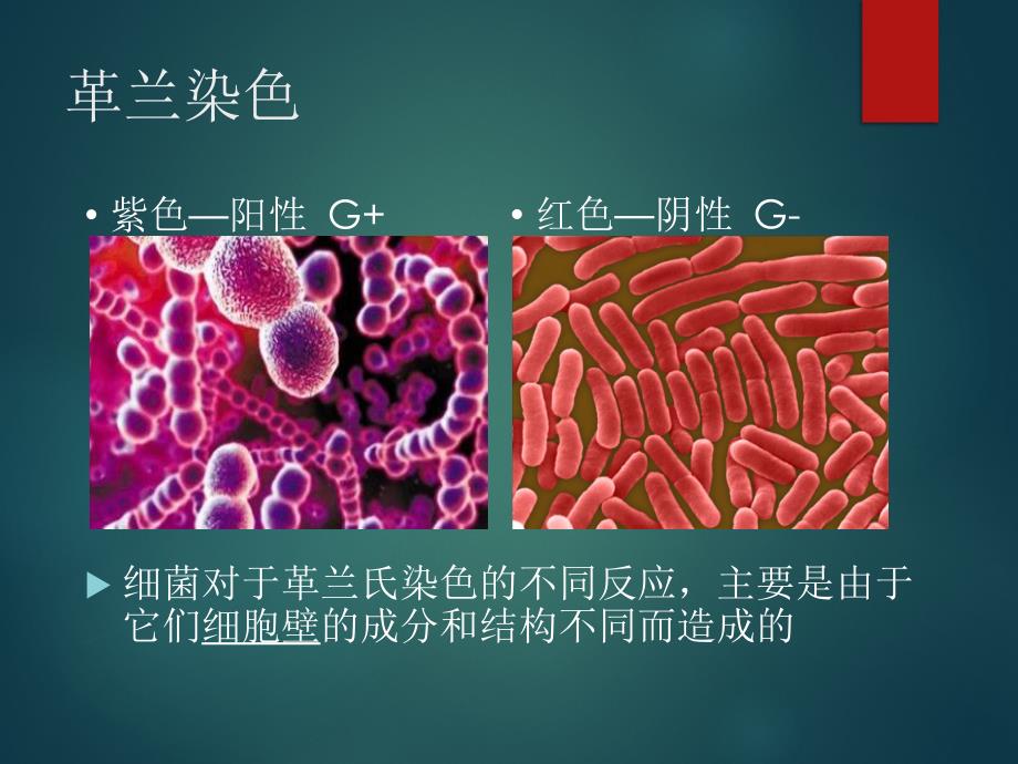 革兰氏阴性菌课件_第3页