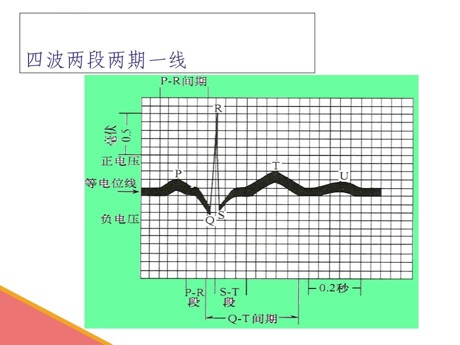 心电图基础知识1课件_第2页