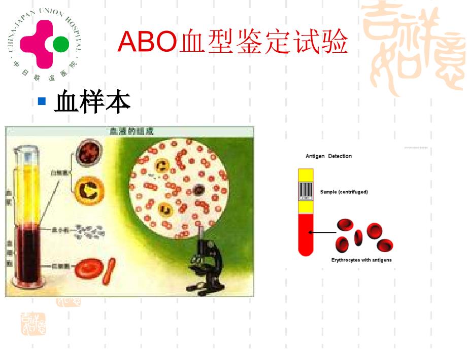 abo血型鉴定试验课件_第2页