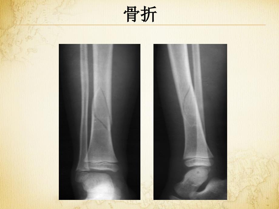 医学影像成像概论课件_第2页