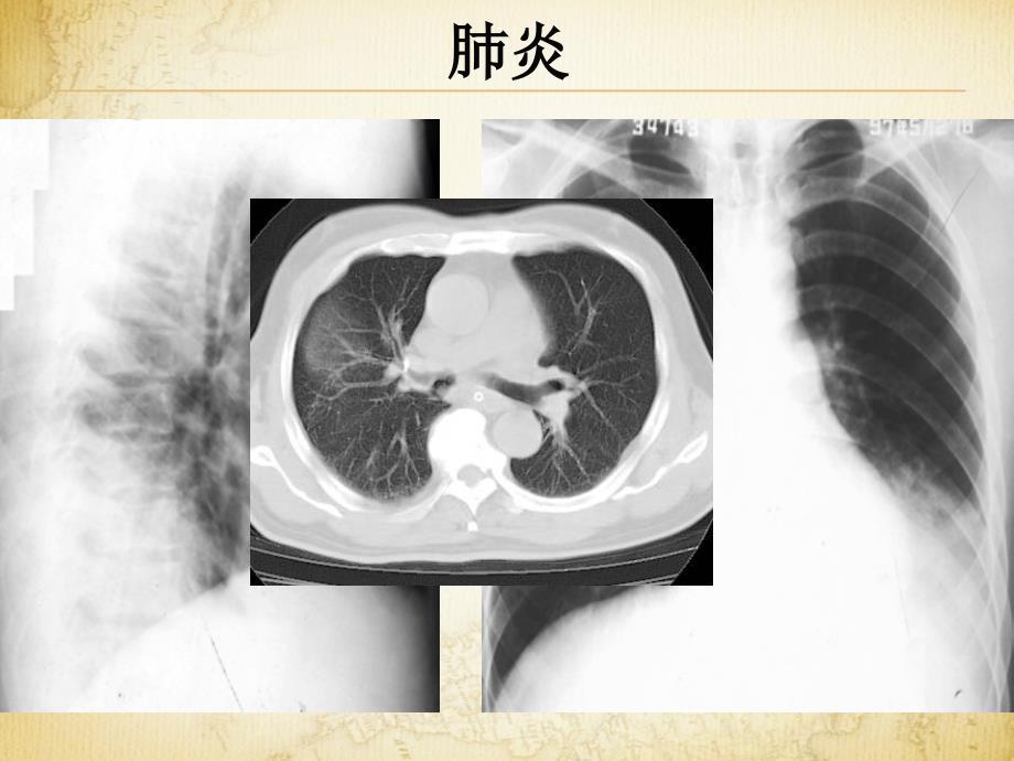 医学影像成像概论课件_第4页