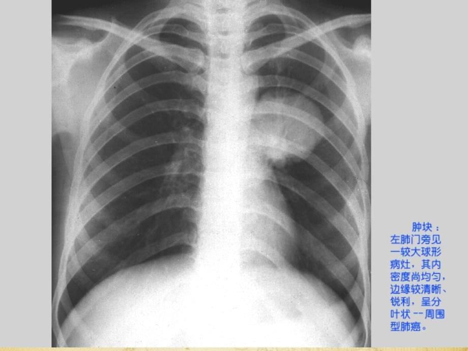 医学影像成像概论课件_第5页