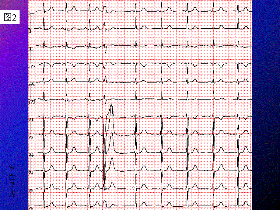 2007级专科医生培训心电图年度考核题课件_第2页