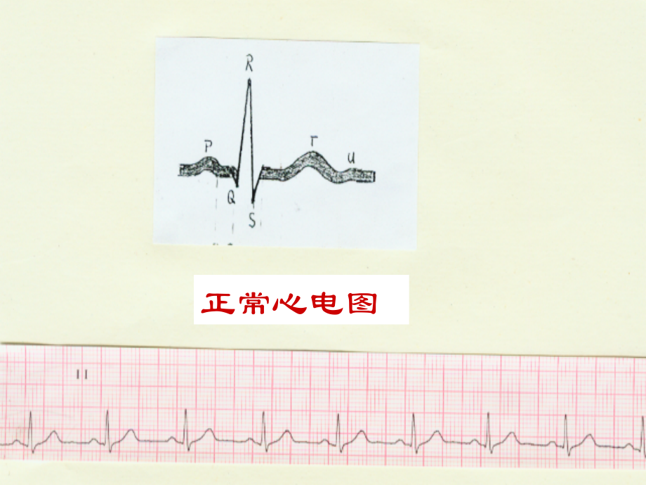 心电图讲义新_第2页