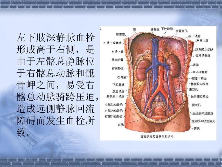 下肢深静脉血栓的预防与护理月课件_第5页