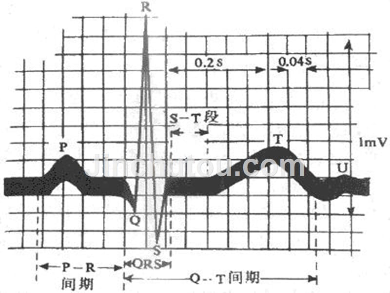 心电图完整版-赵贵林课件_第3页